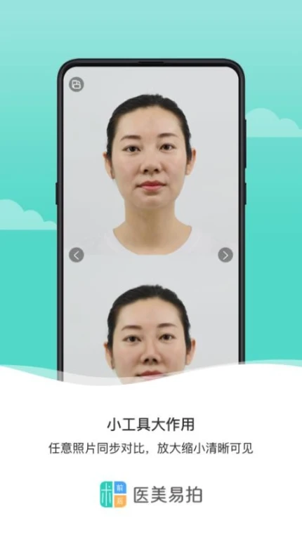 医美易拍appapp